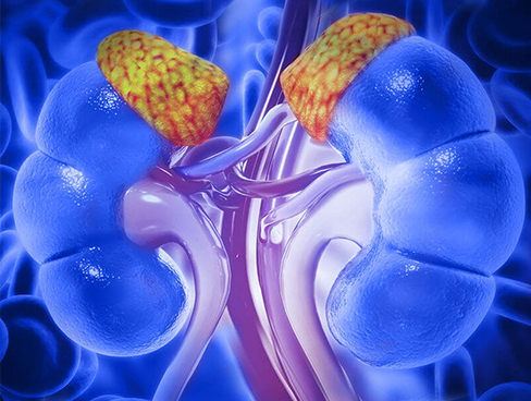 Rastlantısal (Tesadüfen ) Saptanan Adrenal Kitleler - Adrenal İnsidentalomar